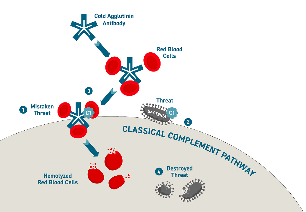 Hemolysis occurs when cold agglutinin antibodies mistakenly identify red blood cells as a threat, activating the classical complement pathway.